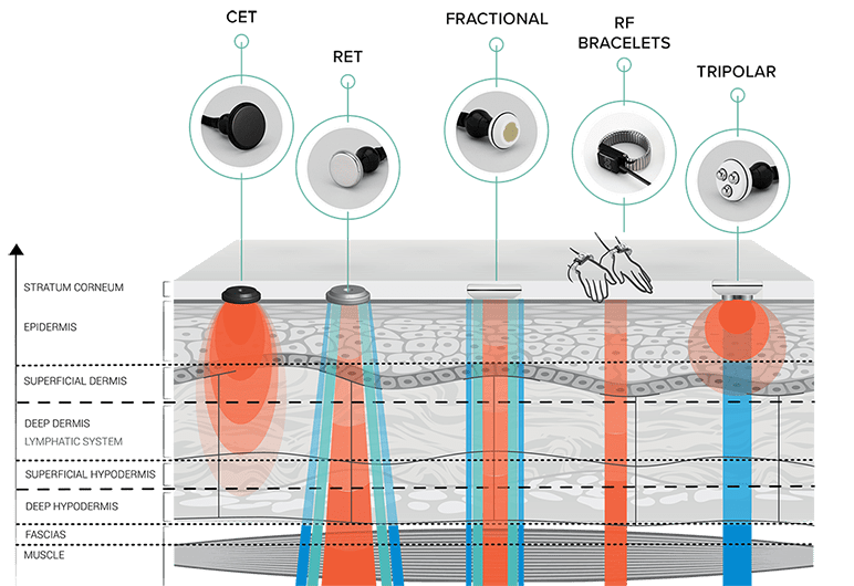 diagram of each attachment depth range