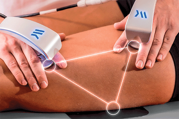 Tecar handles performing treatment on legs