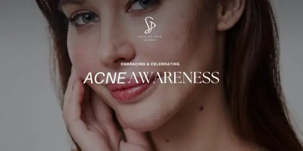 Celebrating Acne Awareness Month with Advanced Solutions